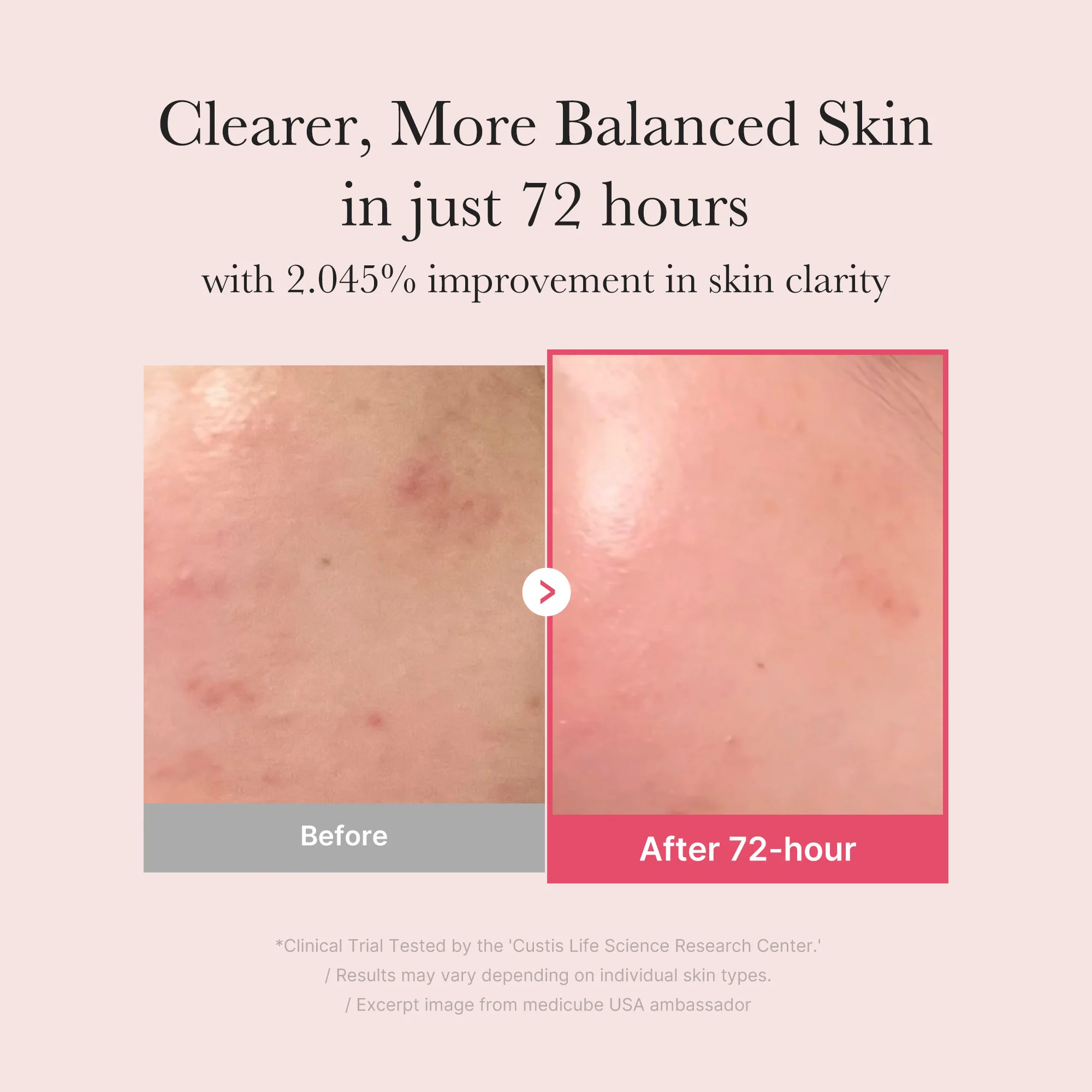 Medicube TXA Niacinamide Serum - Image 3