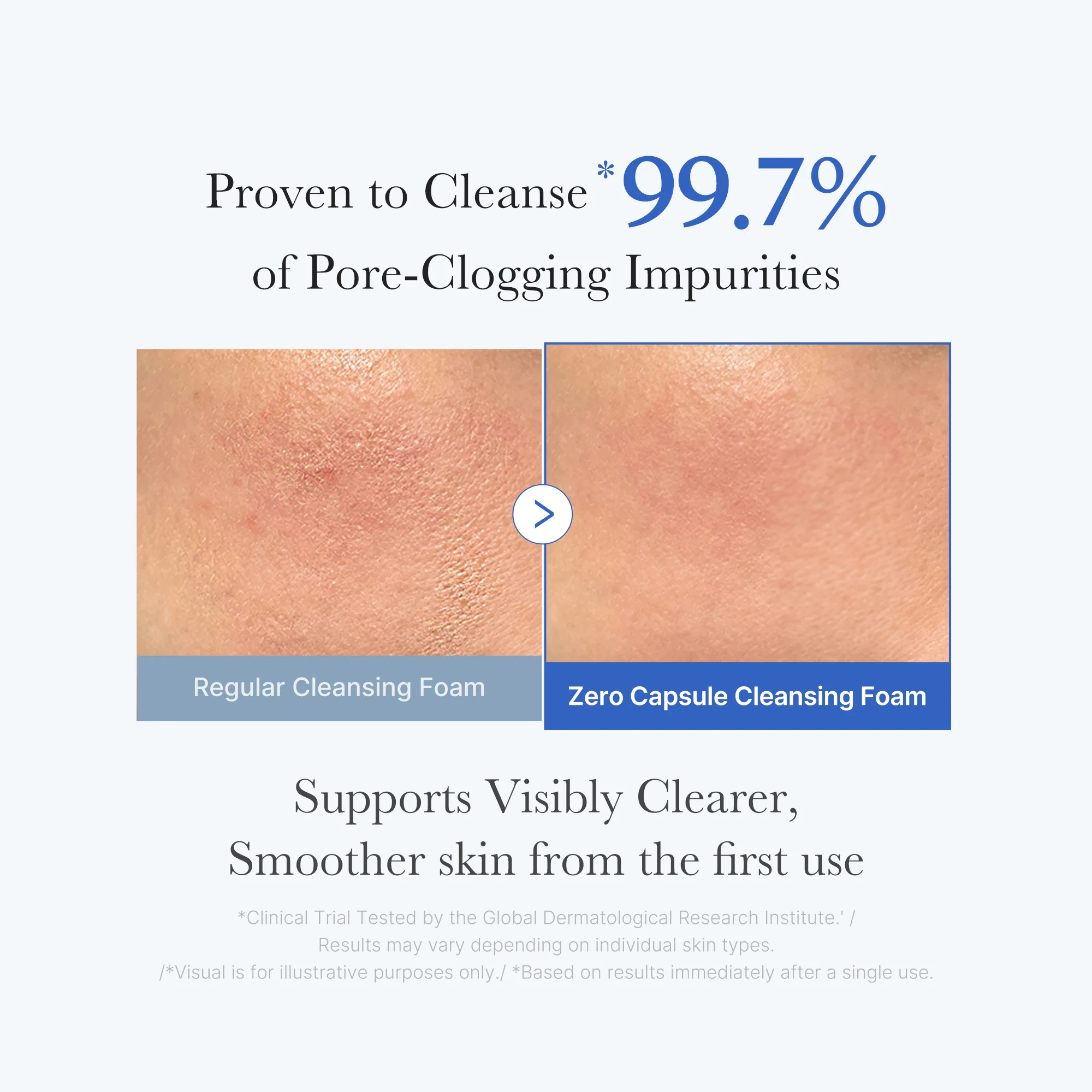 Medicube Zero Pore Capsule Cleansing Foam Cleanser - Image 3