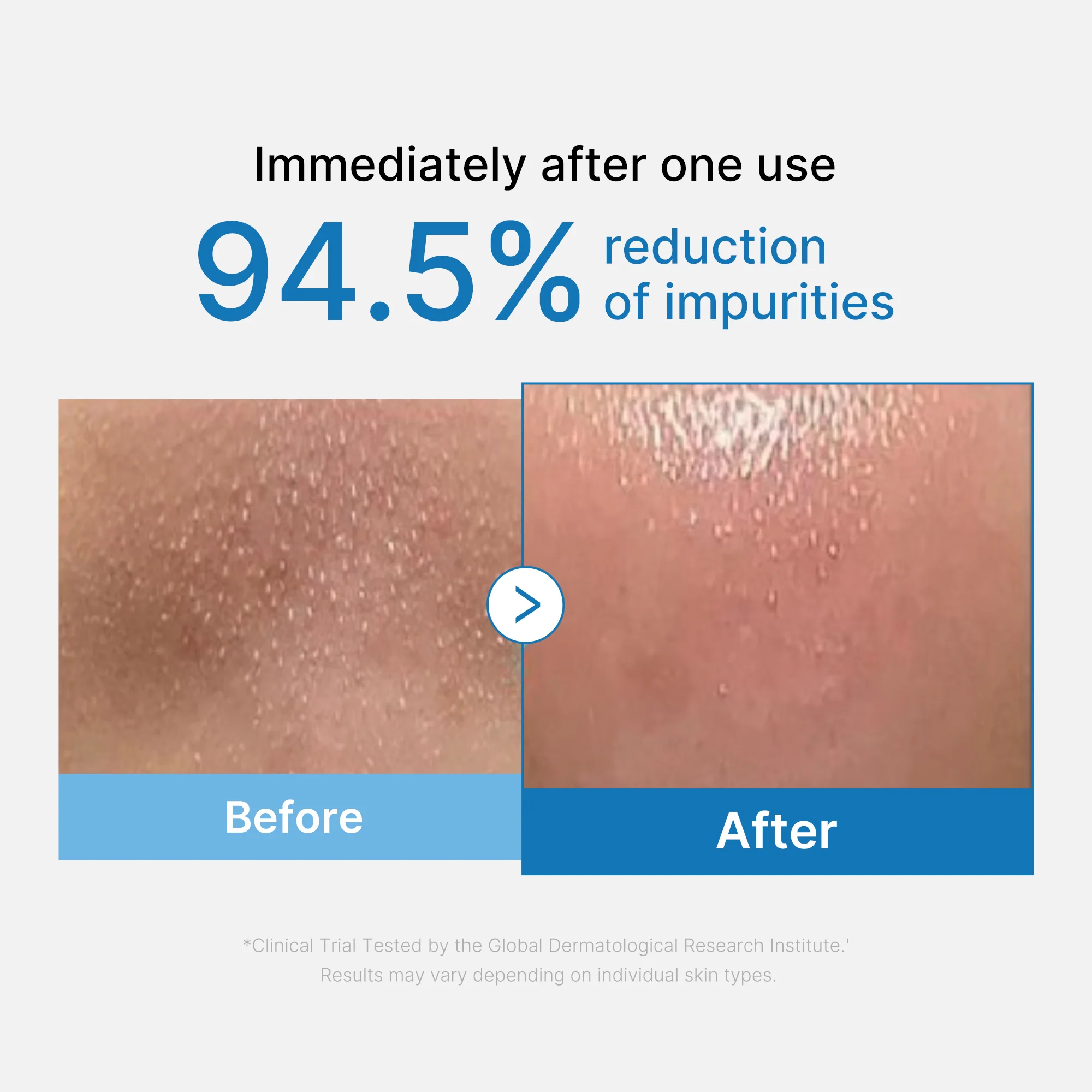 Medicube Zero Pore Blackhead Deep Cleansing Oil - Deep Pore (+Zero Mud Mask) - Image 2